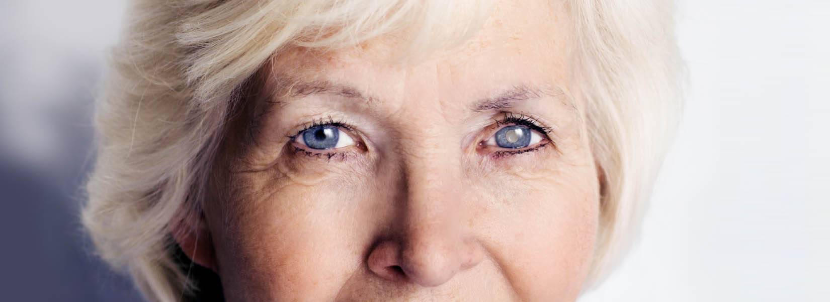 Cataract Surgery in Maricopa